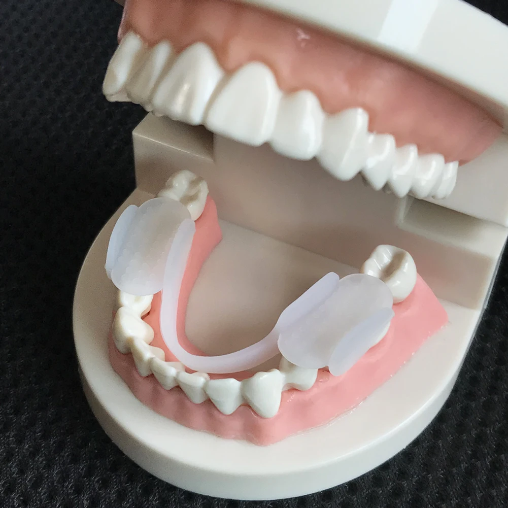 Dental Guard Night - 2 Stuks Tanden Spalk Protector Zachte