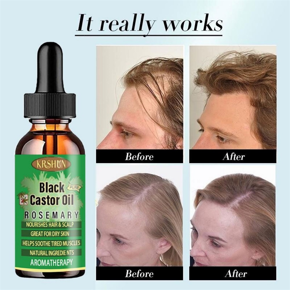 Coconut Oil Pull - Zwarte ricinusolie voedt haargroei huidmassage etherische