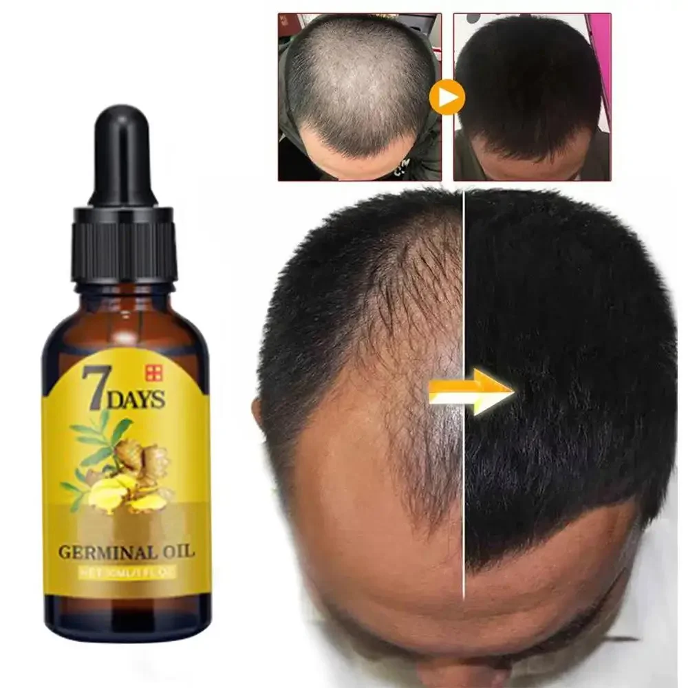Coconut Oil Pull - Haargroei Gember Snelgroeiend haar Essentiële olie