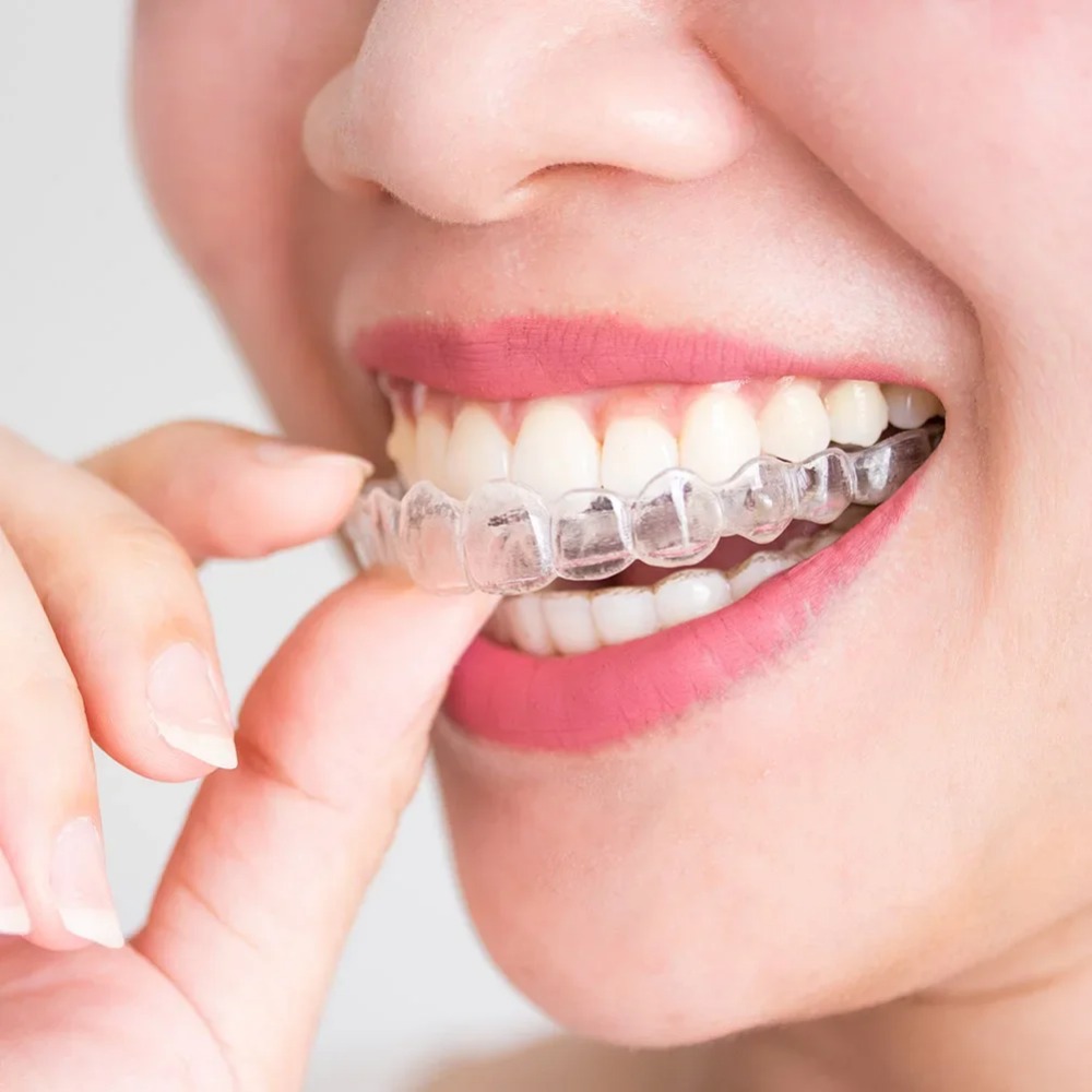 1-4 Stuks Anti-Snorkel- en Bru - Dental Guard Night recensie en prijs
