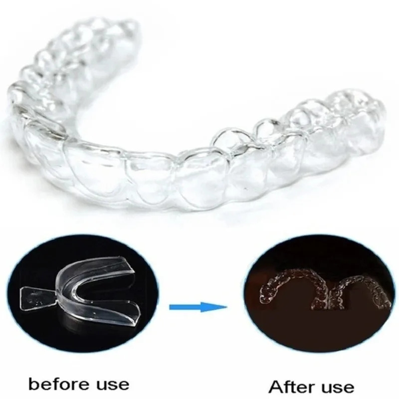 1/3/6pairs Siliconen Mondbesch - Teeth Whitening For Trays recensie en prijs