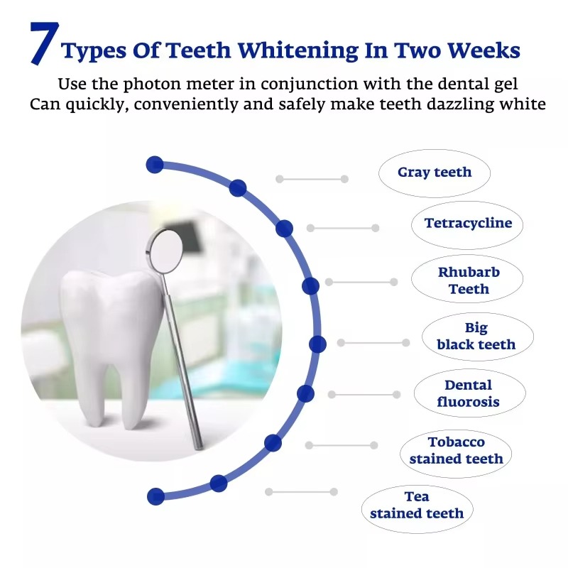 Intelligente LED Blauw Licht D - Teeth Whitening For Trays recensie en prijs