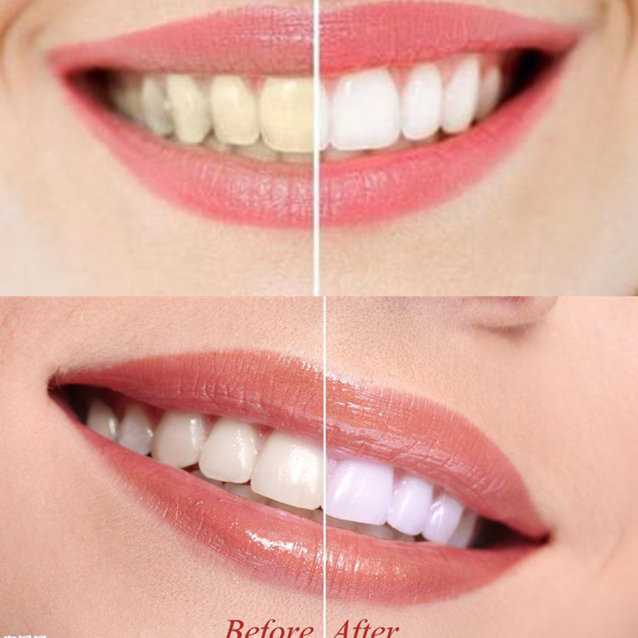Bamboe Houtskool Tanden Dental - Teeth Whitening Quotes recensie en prijs
