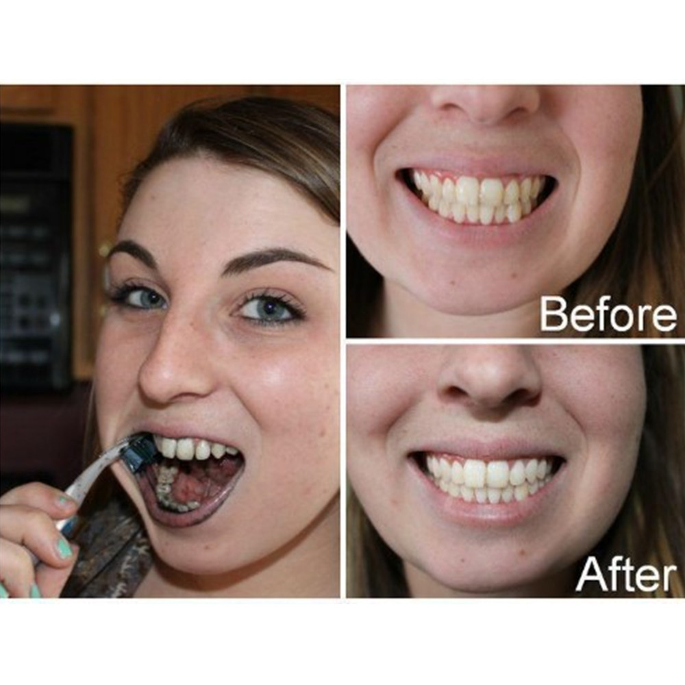 Bamboe Houtskool Tanden Dental - Teeth Whitening Quotes recensie en prijs