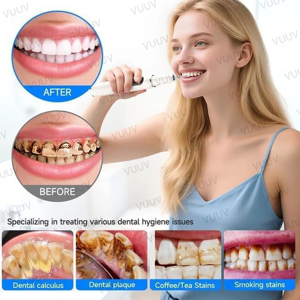 VUUV Ultrasone Tandenreiniger  - Teeth Whitening Uv recensie en prijs