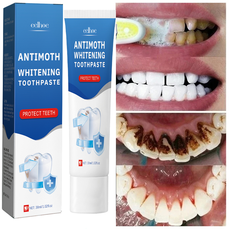 Snel Verwijderen Rookvlekken T - Teeth Whitening Fast recensie en prijs