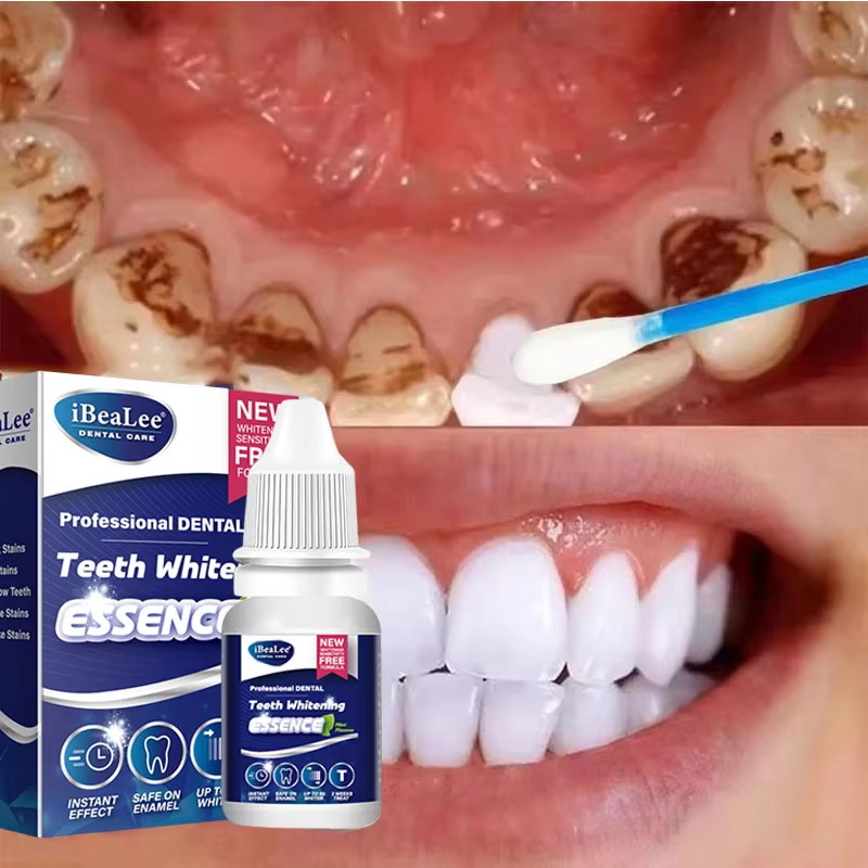 Tanden Whitening Essentie Verw - Teeth Whitening Serum recensie en prijs