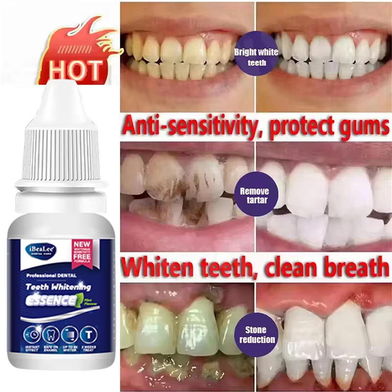Tanden Whitening Essentie Verw - Teeth Whitening Serum recensie en prijs