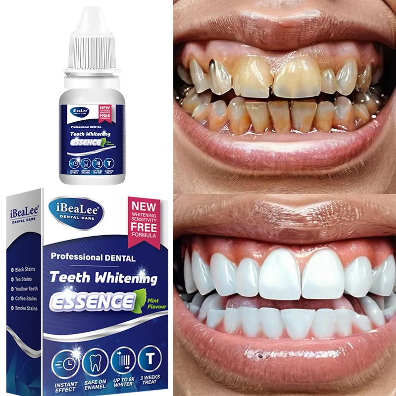Tanden Whitening Essentie Verw - Teeth Whitening Serum recensie en prijs