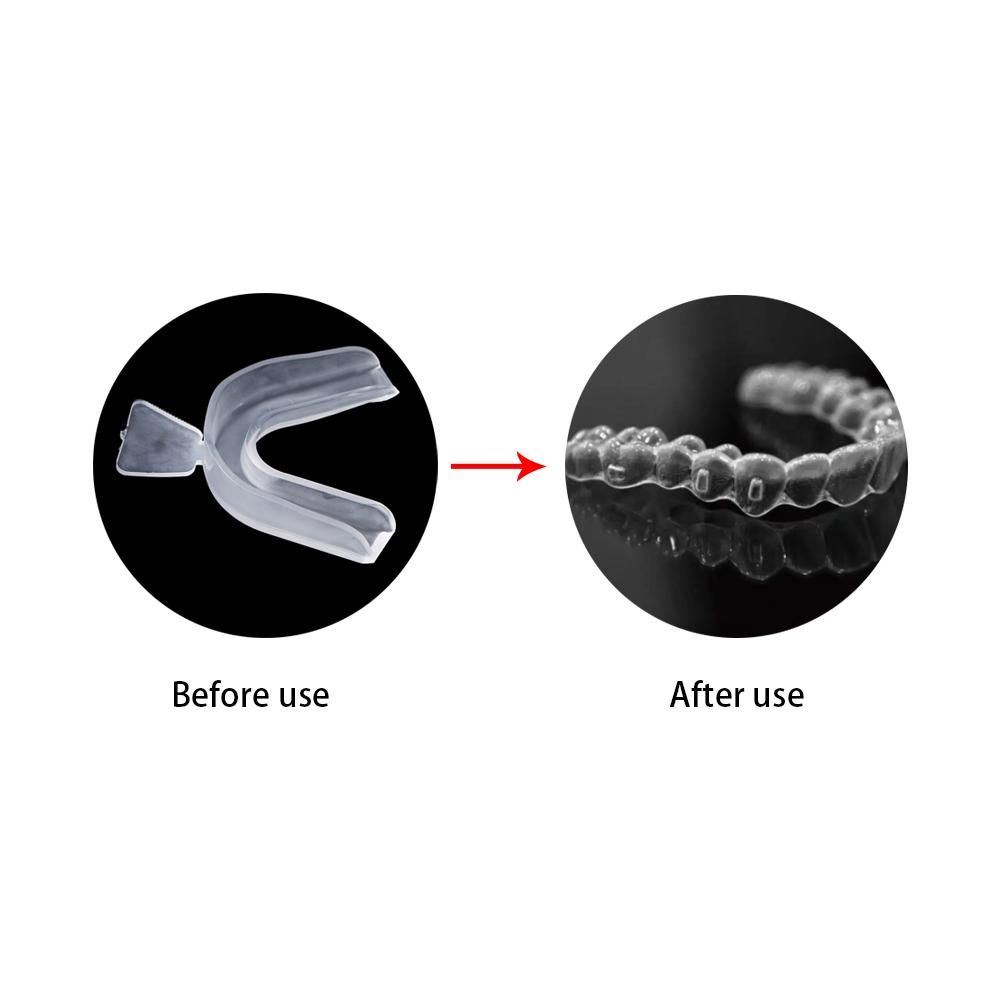 Beschermer Bruxisme Tandenhoez - Teeth Whitening For Trays recensie en prijs