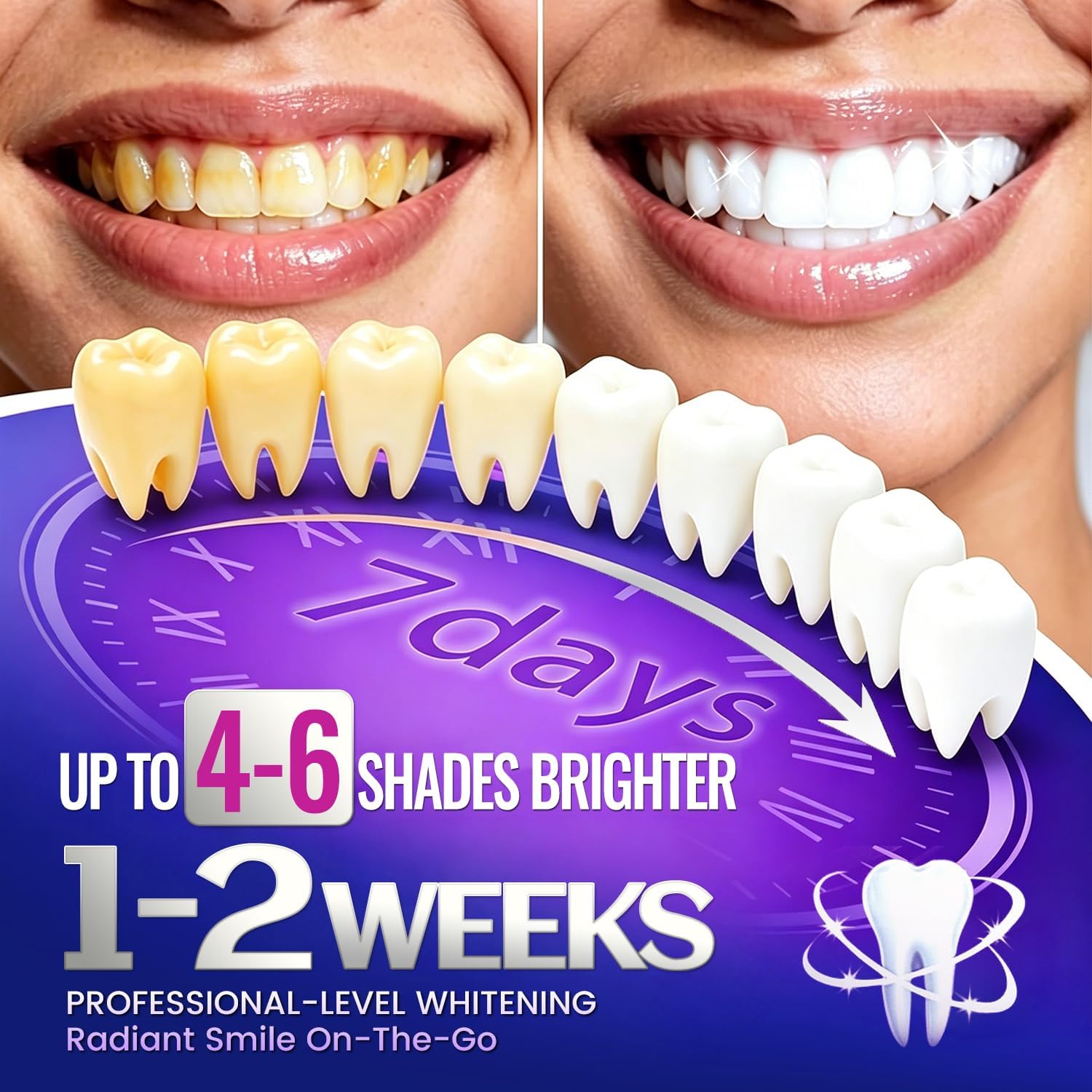 1/7 paar tandenbleekstrips voo - Teeth Whitening Retainer recensie en prijs