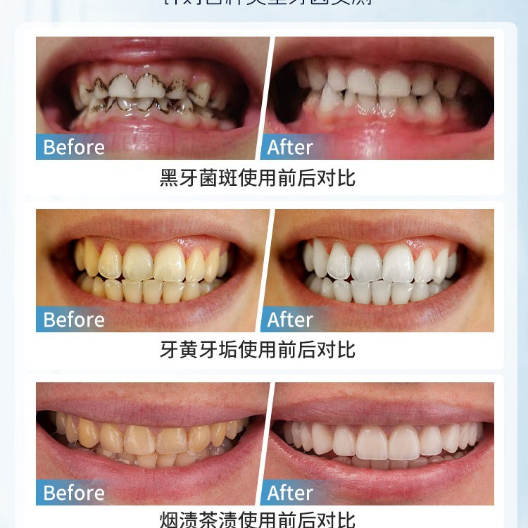 Japan Handmatige Tandvlekverwi - Teeth Whitening In Japan recensie en prijs