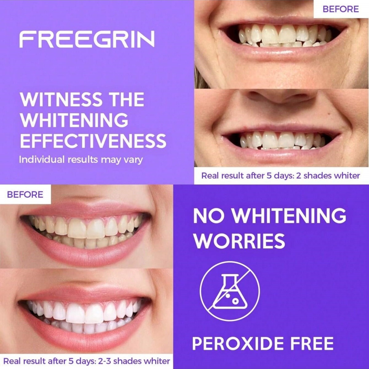 Deluxe Tanden Whitening Sticke - Teeth Whitening Quotes recensie en prijs