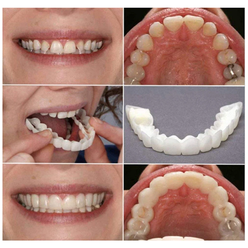 2 Paar Kunstgebittanden Kunstg - Whitening Teeth Dentist recensie en prijs